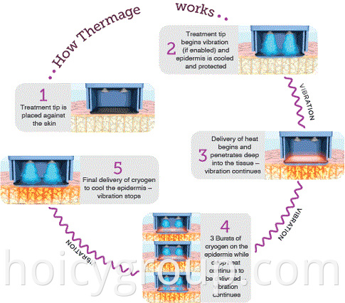 Rf Machine for Face